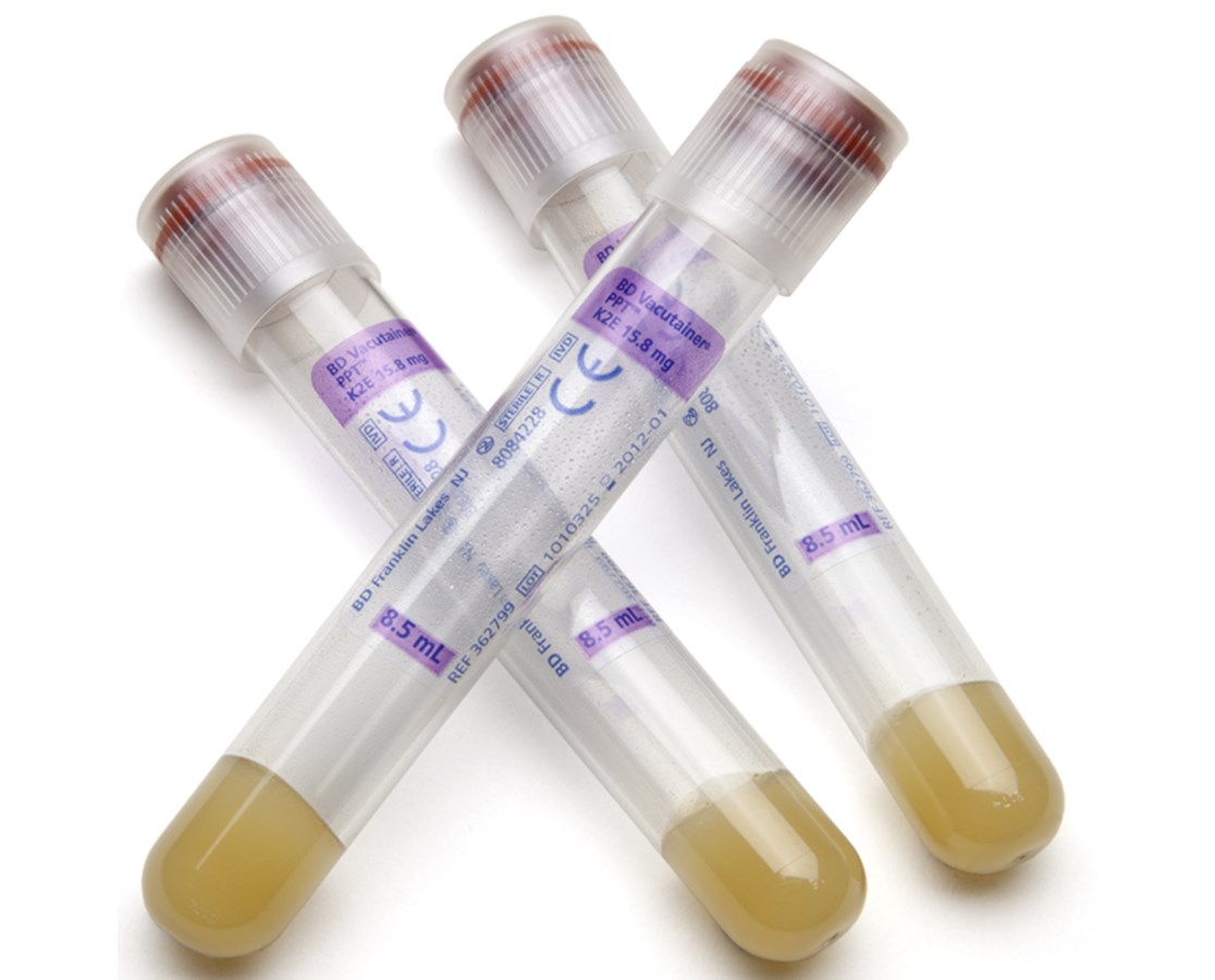 Blood collection tubes Hemogard 5.4 mg EDTA, 3 ml